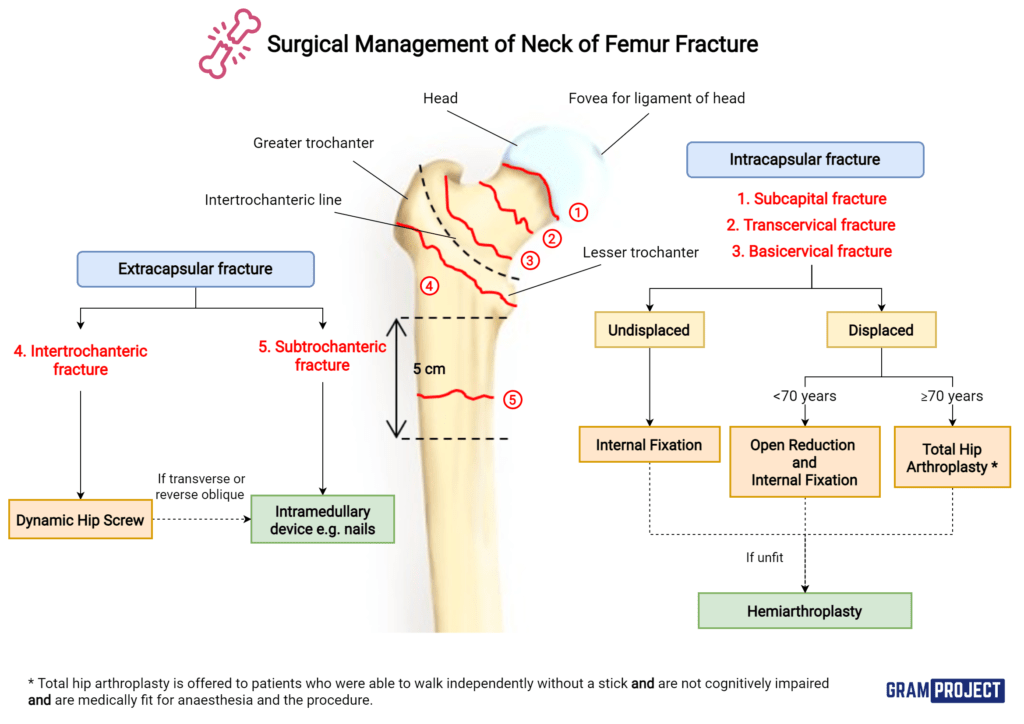 Surgical Management Of Fracture NOF Gram Project   Management Of NOF  1024x724 