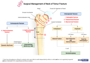 Types of neck of femur fracture and their surgical management